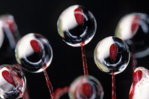 Rosy Sundew Trichomes